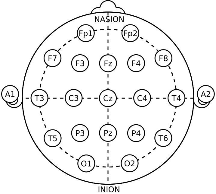 International 10–20 system electrode placement diagram (21 electrodes)